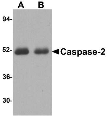 Western Blot: Caspase-2 AntibodyBSA Free [NBP2-26612]