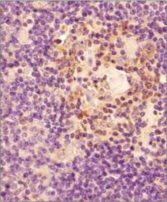 Immunohistochemical Staining of Caspase-3 in Paraffin Embedded Human Spleen