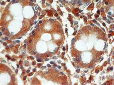 Immunohistochemical Staining of Caspase-3 in Paraffin Embedded Normal Colon