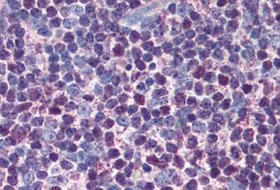 Immunohistochemical Detection of Caspase-3 in Paraffin Embedded Human Thymus