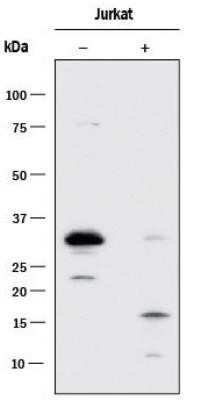 Western Blotting of Caspase-3 in VP-16 Treated and Untreated Jurkat Cells