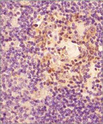 Immunohistochemical Staining of Caspase-3 in Paraffin Embedded Human Spleen