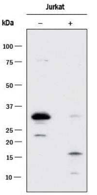 Western Blotting of Caspase-3 in VP-16 Treated and Untreated Jurkat Cells