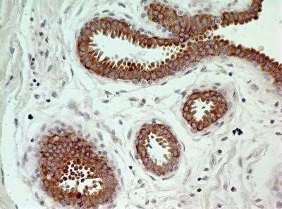 Immunohistochemistry: Caspase-3 Antibody (31A893) - Azide and BSA Free [NBP2-80613]