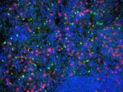 Immunohistochemistry-Frozen: Caspase-3 Antibody (CPP32 4-1-18) - BSA Free [NB500-210]