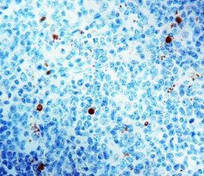 Immunohistochemistry-Paraffin: Caspase-3 Antibody [NB600-1235]