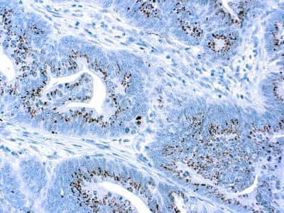 Immunohistochemistry-Paraffin: Caspase-3 Antibody [NB600-1235]