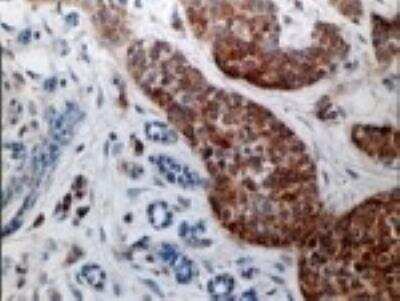 Immunohistochemistry-Paraffin: Caspase-3 Antibody - (Pro and Active) [NB100-56112]