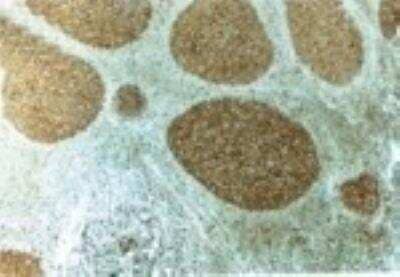 Immunohistochemistry-Paraffin: Caspase-3 Antibody - (Pro and Active) [NB100-56112]