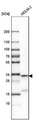 Western Blot: Caspase-3 Antibody [NBP1-90125]