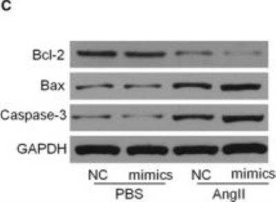 Western Blot: Caspase-3 Antibody(active/cleaved) [NB100-56113]