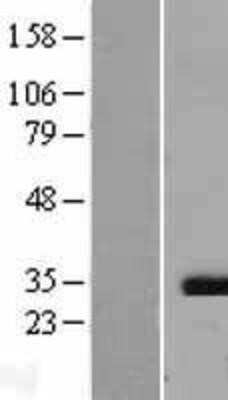 Western Blot: Caspase-3 Overexpression Lysate [NBL1-08711]