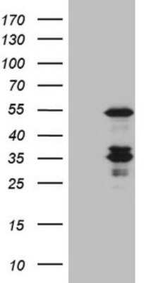 Western Blot: Caspase-4 Antibody (OTI4A2) [NBP2-46065]