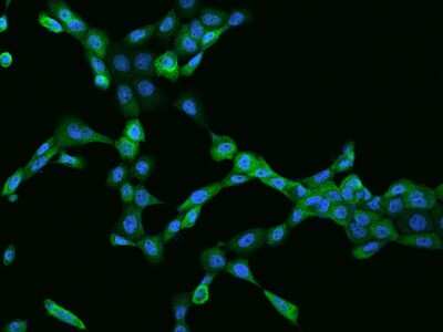 Immunocytochemistry/ Immunofluorescence: Caspase-4 Antibody [NBP2-97308]