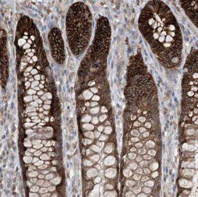 Immunohistochemistry-Paraffin: Caspase-4 Antibody [NBP1-87681]