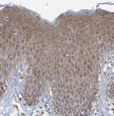 Immunohistochemistry-Paraffin: Caspase-4 Antibody [NBP1-87681]