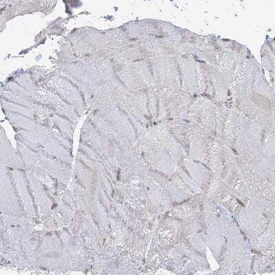 Immunohistochemistry-Paraffin: Caspase-4 Antibody [NBP1-87681]