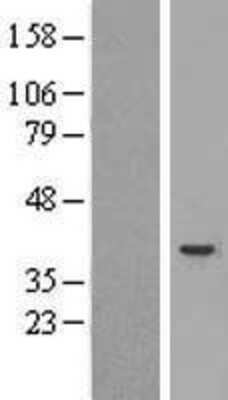 Western Blot: Caspase-4 Overexpression Lysate [NBL1-08713]