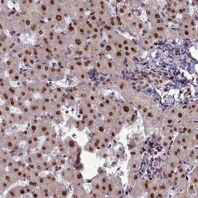 Immunohistochemistry-Paraffin: Caspase 5 Antibody [NBP1-87682]