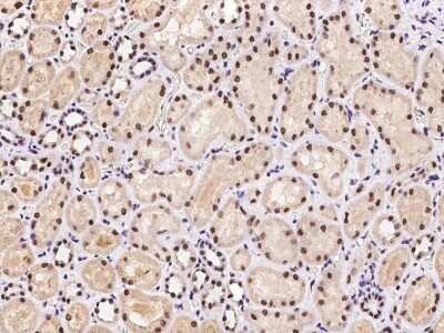 Immunohistochemistry-Paraffin: Caspase 5 Antibody [NBP2-98202]