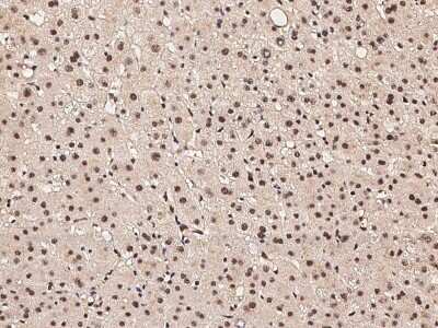 Immunohistochemistry-Paraffin: Caspase 5 Antibody [NBP2-98202]