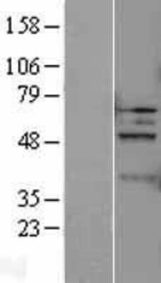 Western Blot: Caspase 5 Overexpression Lysate [NBL1-08714]