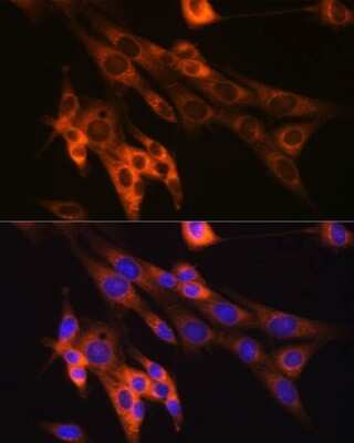 Immunocytochemistry/ Immunofluorescence: Caspase-6 Antibody (2W4G2) [NBP3-15775]