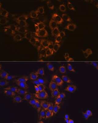 Immunocytochemistry/ Immunofluorescence: Caspase-6 Antibody (6D7S2) [NBP3-15771]