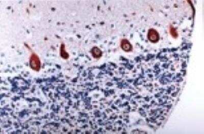 Immunohistochemistry: Caspase-6 Antibody [NB100-56114]