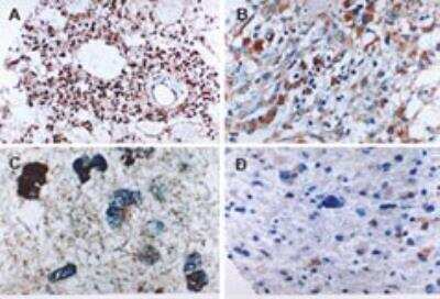 Immunohistochemistry-Paraffin: Caspase-6 Antibody [NB100-56114]