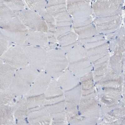 Immunohistochemistry-Paraffin: Caspase-6 Antibody [NBP1-87683]