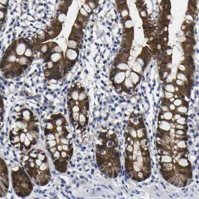 Immunohistochemistry-Paraffin: Caspase-6 Antibody [NBP1-87683]