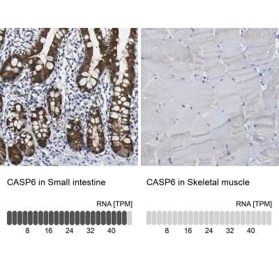 Immunohistochemistry-Paraffin: Caspase-6 Antibody [NBP1-87683]