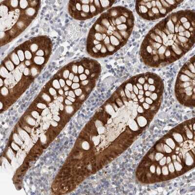 Immunohistochemistry-Paraffin: Caspase-6 Antibody [NBP1-87684]