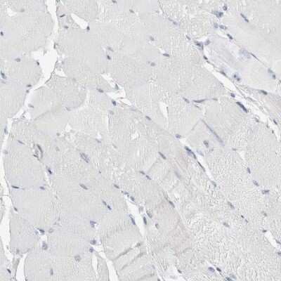 Immunohistochemistry-Paraffin: Caspase-6 Antibody [NBP1-87684]
