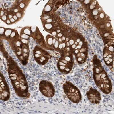 Immunohistochemistry-Paraffin: Caspase-6 Antibody [NBP1-87684]