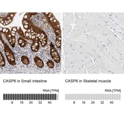 Immunohistochemistry-Paraffin: Caspase-6 Antibody [NBP1-87684]