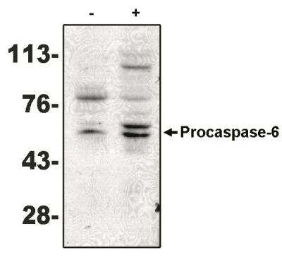 Western Blot: Caspase-6 Antibody (MCH2 14 1-190) [NBP2-66612]