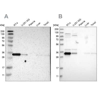 Western Blot: Caspase-6 Antibody [NBP1-87683]