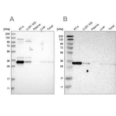 Western Blot: Caspase-6 Antibody [NBP1-87684]