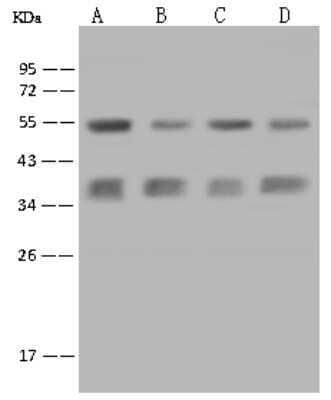 Western Blot: Caspase-6 Antibody [NBP2-99463]