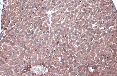 Immunohistochemistry-Paraffin: Caspase-6 Antibody - (cleaved) [NBP3-13380]