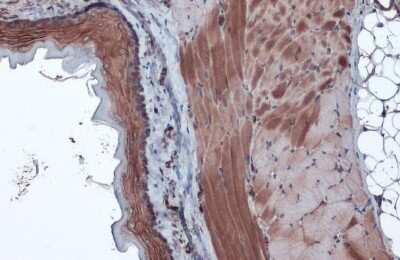 Immunohistochemistry-Paraffin: Caspase-6 Antibody - (cleaved) [NBP3-13380]