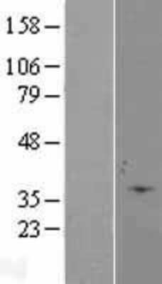 Western Blot: Caspase-6 Overexpression Lysate [NBL1-08715]