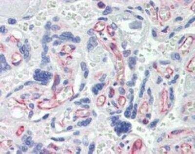 Immunohistochemistry: Caspase-7 Antibody (7-1-11) [NBP1-19229]