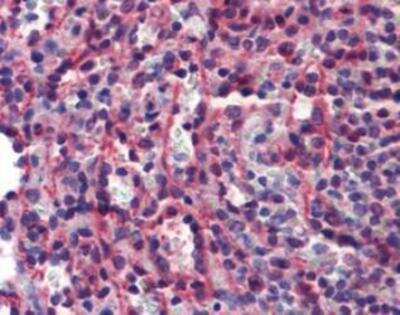 Immunohistochemistry: Caspase-7 Antibody (7-1-11) [NBP1-19229]