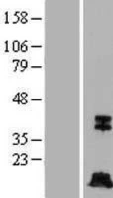 Western Blot: Caspase-7 Overexpression Lysate [NBP2-05889]