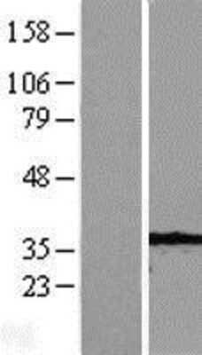 Western Blot: Caspase-7 Overexpression Lysate [NBP2-10963]