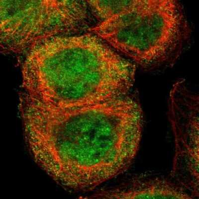 Immunocytochemistry/ Immunofluorescence: Caspase-8 Antibody [NBP1-88185]