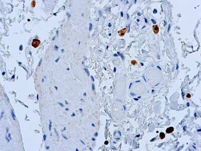 Immunohistochemistry-Paraffin: Caspase-8 Antibody [NB600-576]